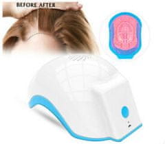 Yalong Trade LED helma na podporu růstu vlasů